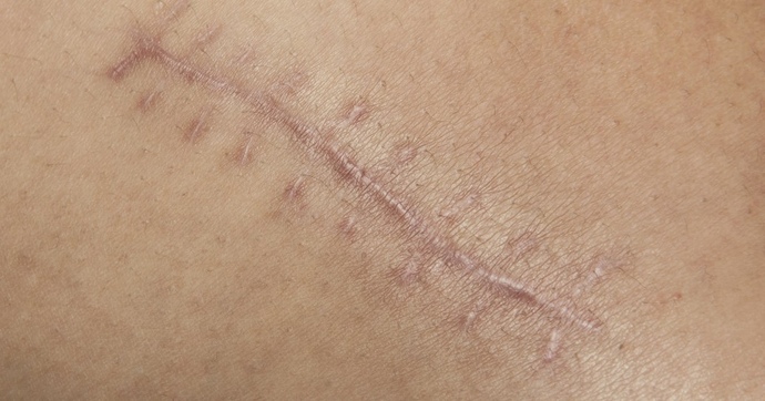Do you have an impressive scar?