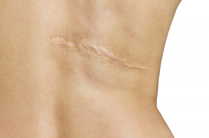 Do you have an impressive scar?