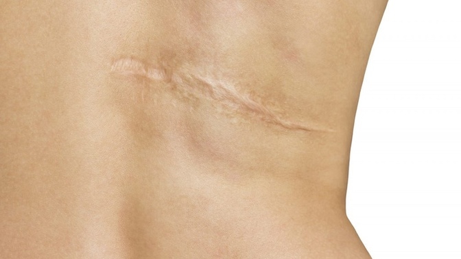 Do you have an impressive scar?