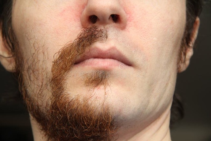 How would you react if you saw a guy walking around with a half mustache or beard as if it was normal?
