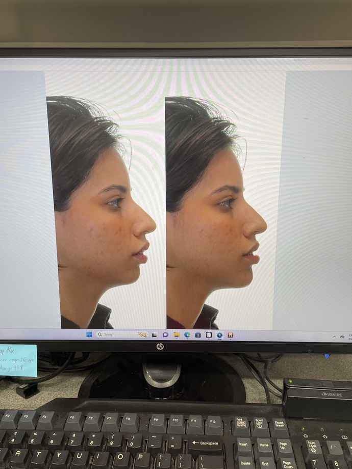 Do I have a receding chin?