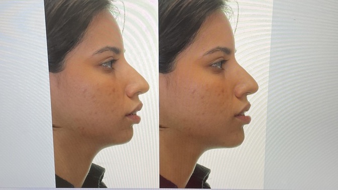 Do I have a receding chin?