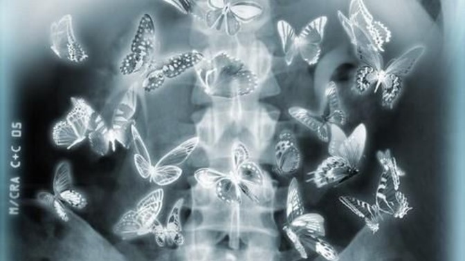 When someone gives you butterflies, what does it mean?