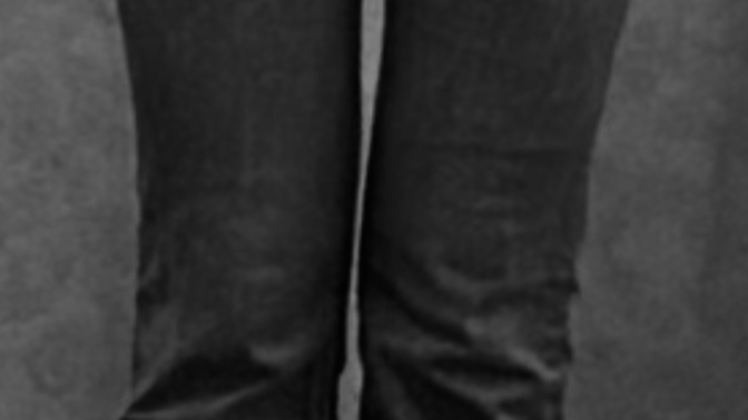 Are my thighs weird?