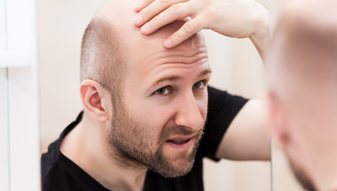 Should men who are balding just shave that thing already?