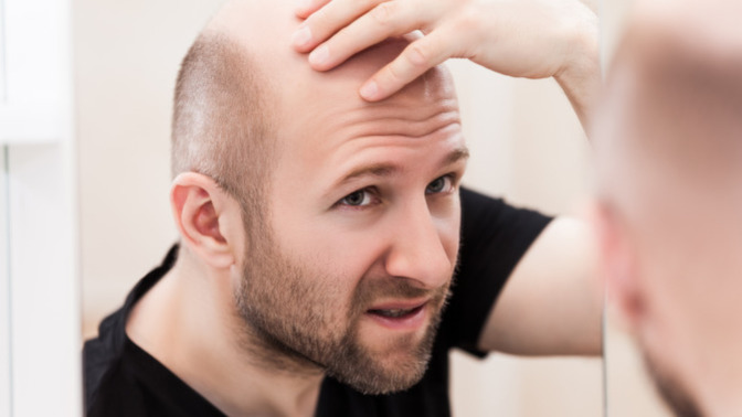Should men who are balding just shave that thing already?