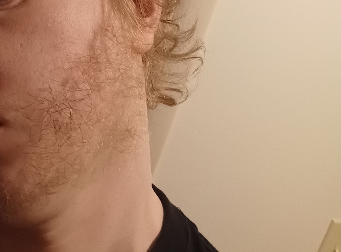 Can you grow a nest inside my beard?