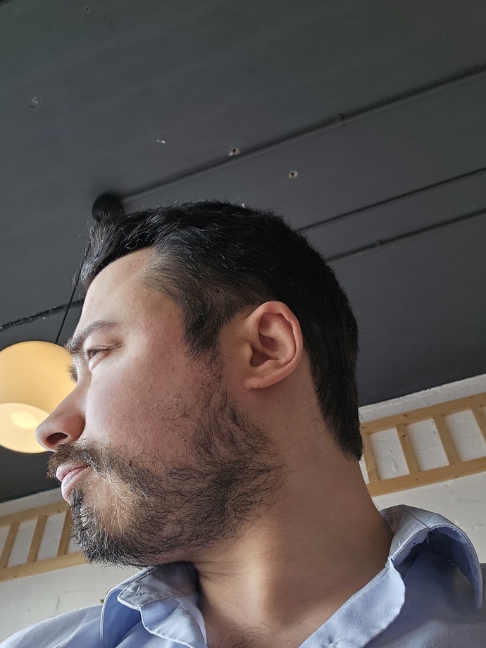 Why are my cheeks going red all of a sudden?