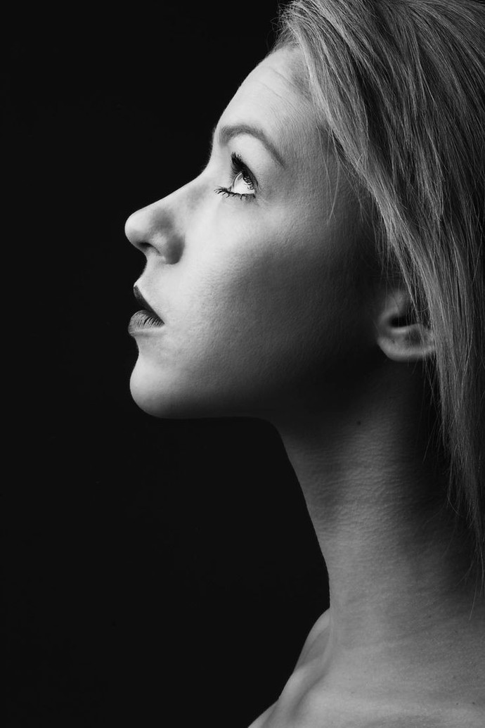 Does she need a rhinoplasty and lip fillers?