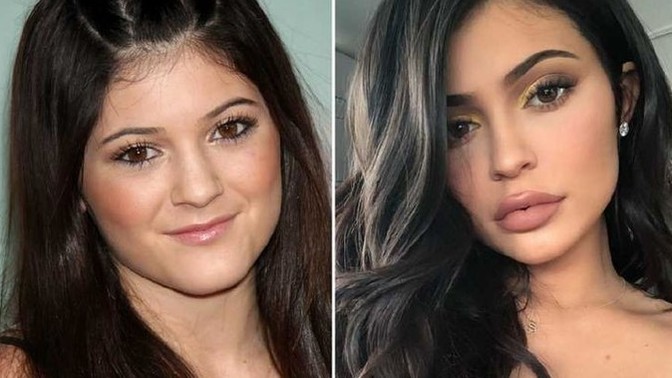 Do you think it's racist to expect all women to have facial features more common among African women naturally in order to be considered pretty?