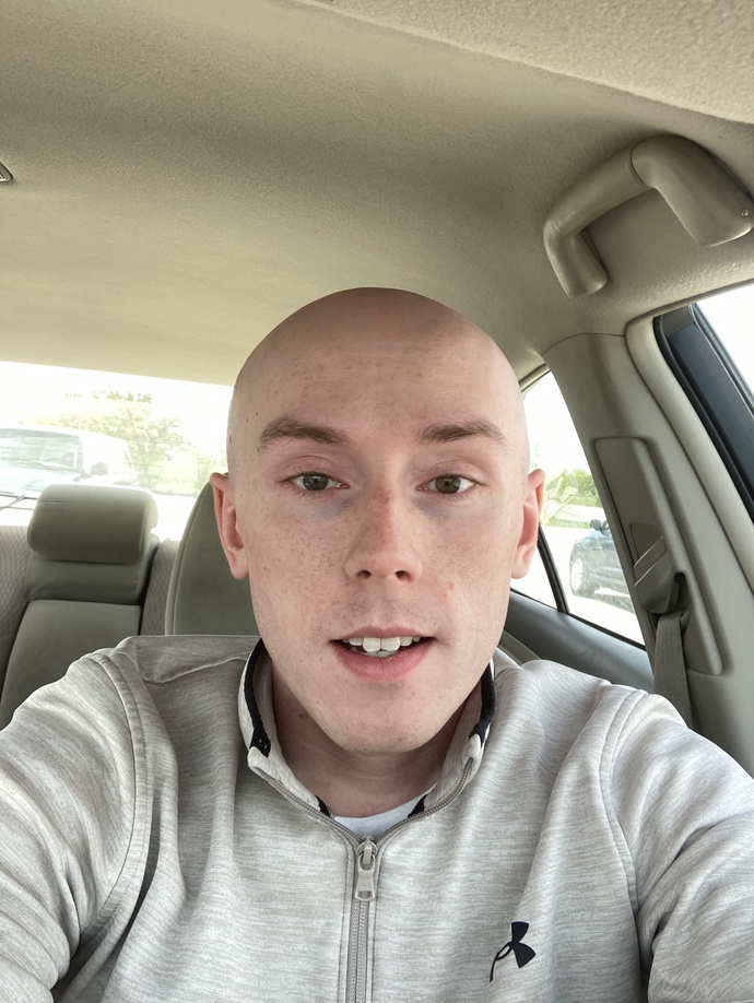 Girls in your 20’s, can a guy your age who’s bald (shaved) be attractive physically? Would you date a bald guy?