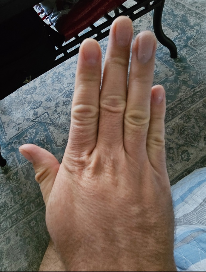 Do you have sausage fingers?