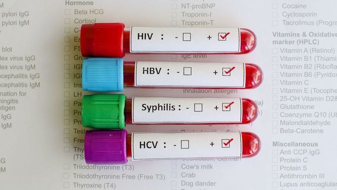 How often and why do you get STI/STD tested by your general practitioner?
