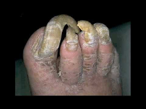Is it a turn off if your partner has smelly feet?