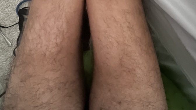 Why are my legs so skinny and seem to curve inward?