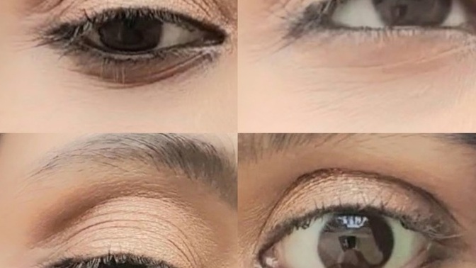 Fine lines under eyes?