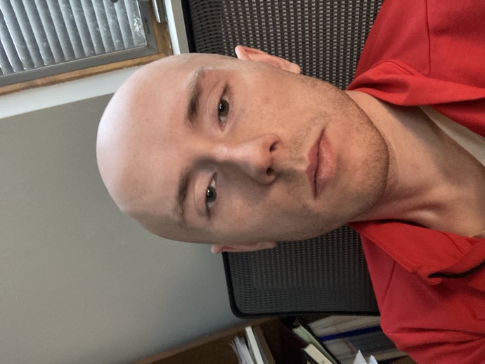 Girls (20’s) can a guy your age who’s bald still be good looking? would you date a bald guy so young or is it often a dealbreaker?
