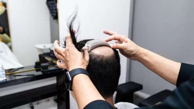 What kind of services does hair replacement provide?