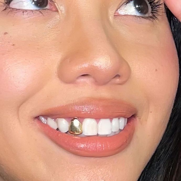If you were to get a gold tooth cap grill as a style look, which placement you would get the cap on?