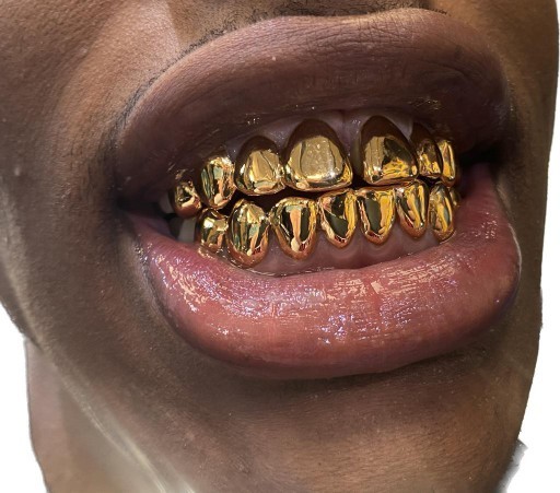 Do you find grillz teeth physically attractive?