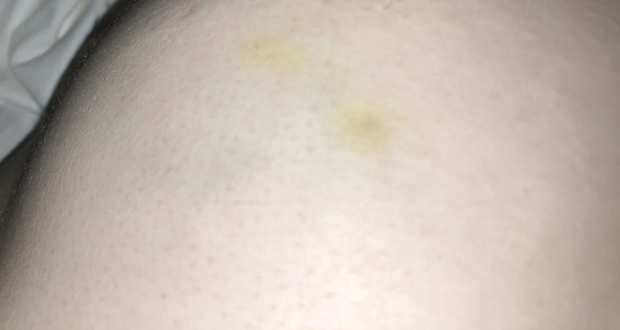 What are these? yellow dots on my breasts?