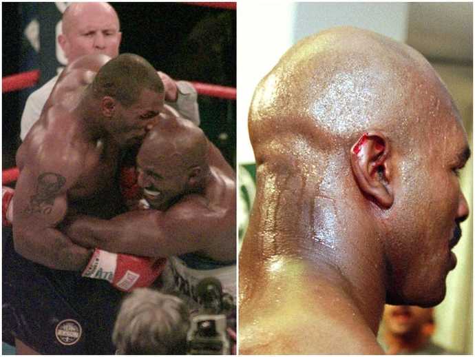 Would you forgive someone who bit part of your ear off like Tyson did to Holyfield?