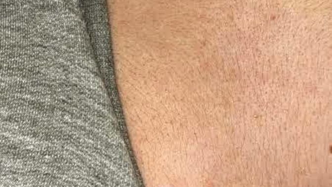 But fuzzy chest on a girl?