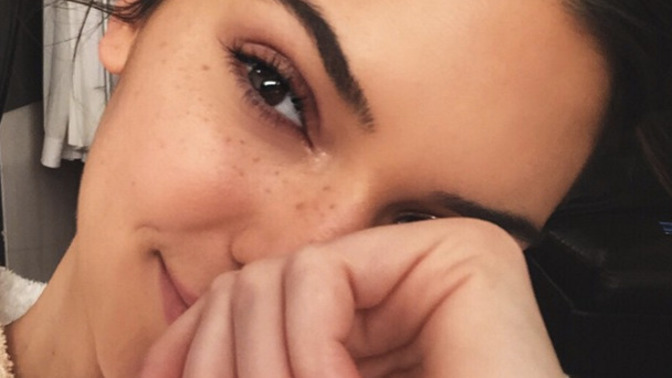 What do you think about freckles?