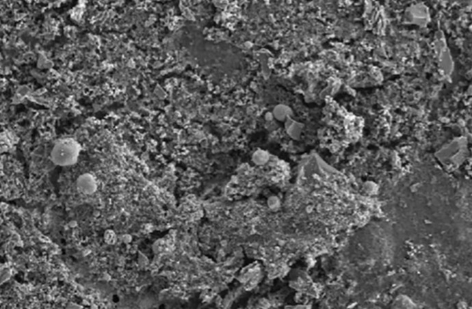 microscope image of microplastic particles in penis tissue ( International Journal of Impotence Research)