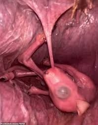 When did you discover kangaroo pouches was a part of them and it looks weird?