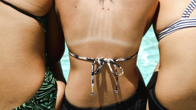 Late Summer Series: How Do You Feel About Tan Lines?