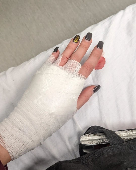 Last time u went to the hospital?