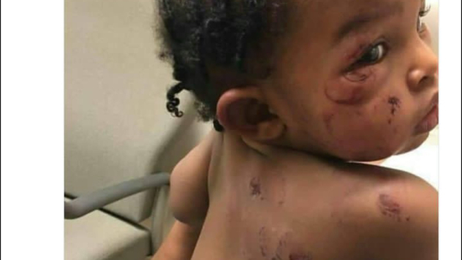 What would y’all do as a parent if this was y’all baby if you see this?