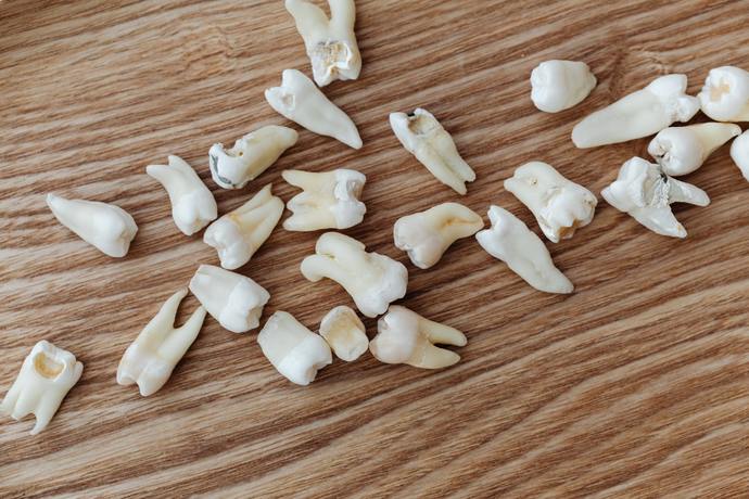How many years ago was the last time you lost a tooth?
