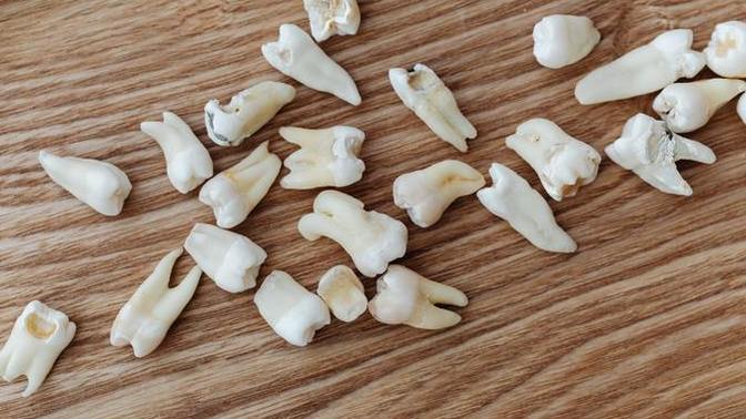 How many years ago was the last time you lost a tooth?