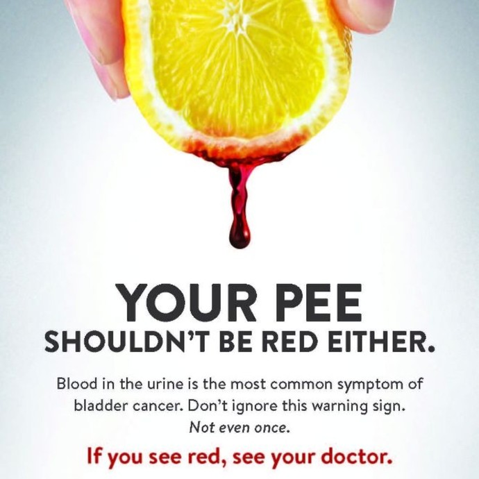 Have you ever peed dark brown after a hot day at work?