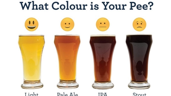Have you ever peed dark brown after a hot day at work?
