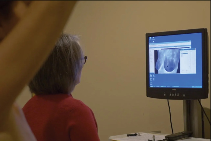 Girls, have you ever had a mammogram or biopsy?