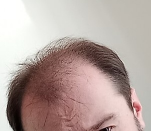 Is my hair so bad?