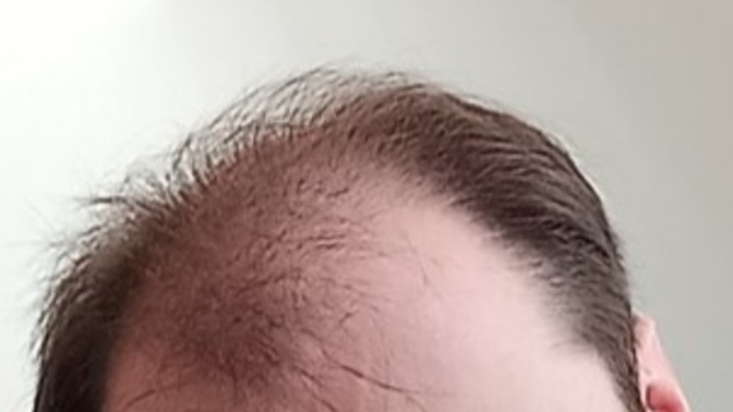 Is my hair so bad?