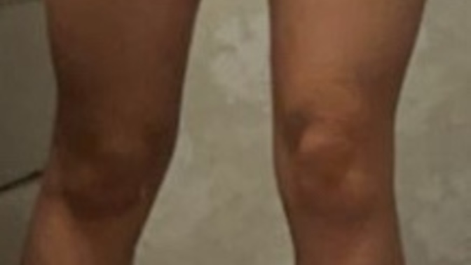 Guys do you like girls with muscular “running girl” legs?