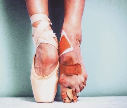 Will I be able to do ballet if my big toes are just huge and almost 2 cm longer than the second toe?