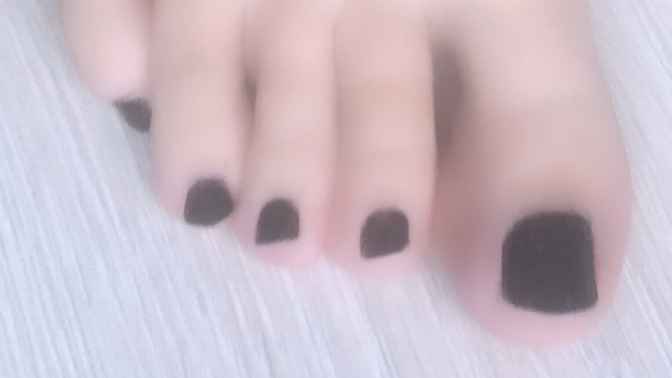 Will I be able to do ballet if my big toes are just huge and almost 2 cm longer than the second toe?
