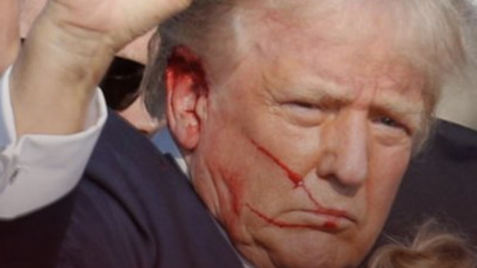 Did you know what Trump said after he was shot?