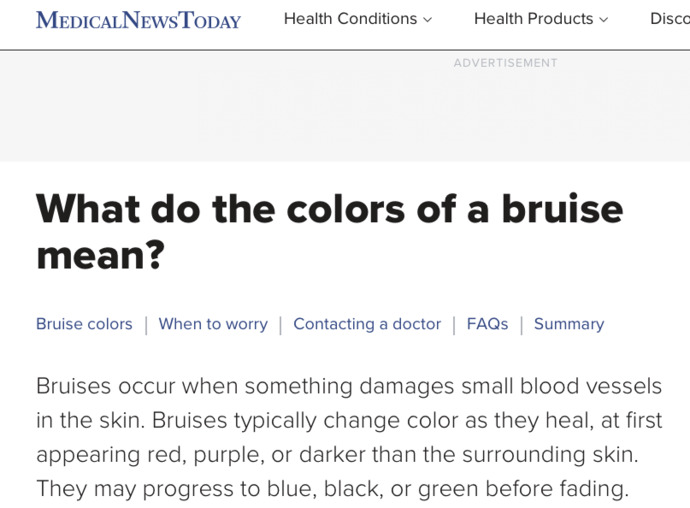 Is this a bruise or skin cancer?
