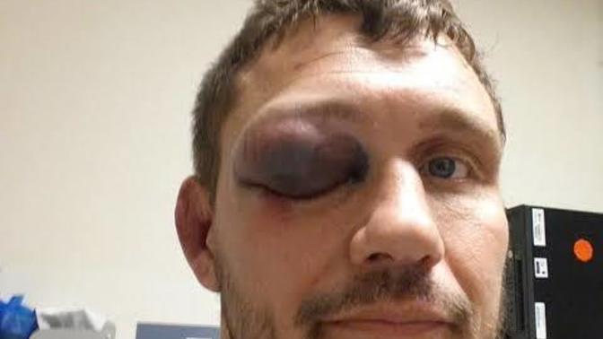 When eyes are closed after being hit like this, does it become blind?