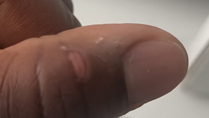 How much time will it take to heal?