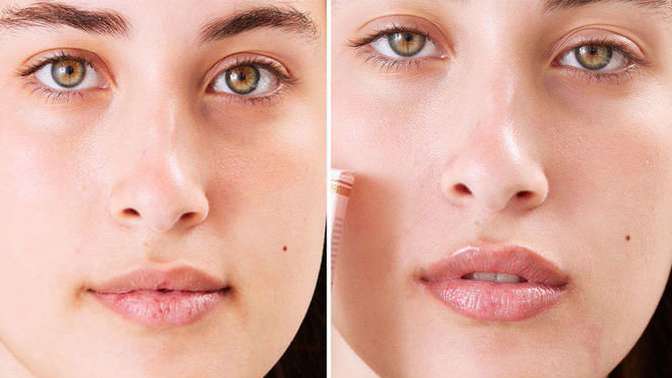 Why do many girls thicken their lips?