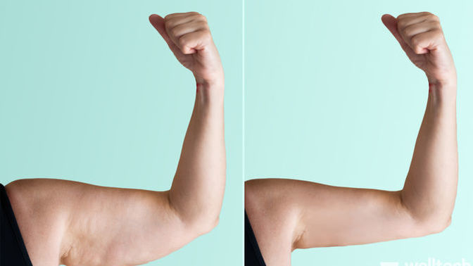 Which part of your body is in need of much-needed improvement?