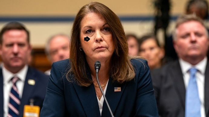 Should Kimberly Cheatle get that thing on her nose looked at? ?